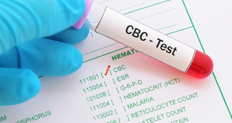 Clarify CBC Test Result: Your Blood Tells about Your Health