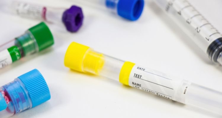 Clarify CBC Test Result: Your Blood Tells about Your Health